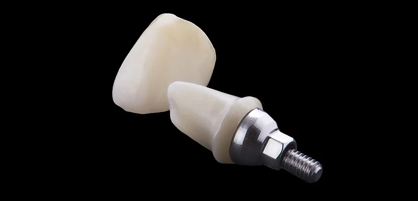 Benefits Of Zirconia Crowns